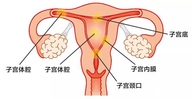 以前流产可以检查出来吗 妇产科诊断报告能看出既往人流史吗