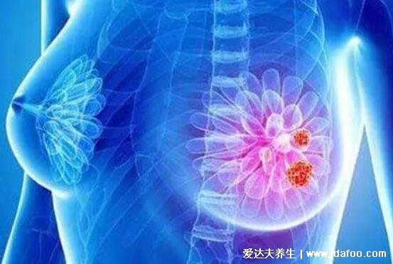 乳腺增生结节怎么调理最好方法，重点保持良好心态