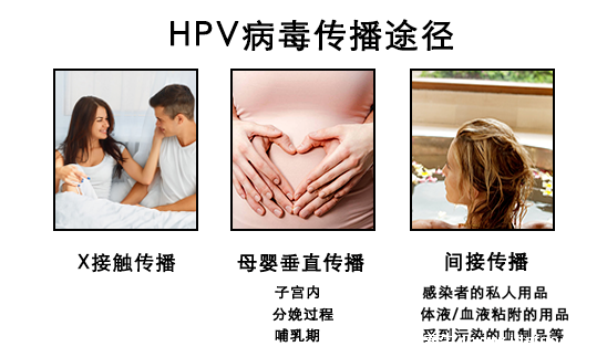 感染HPV病毒 就会恶变成宫颈癌吗？造成宫颈癌的真正真相究竟是什么？